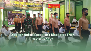 apakah bekas laser tato bisa lolos tni