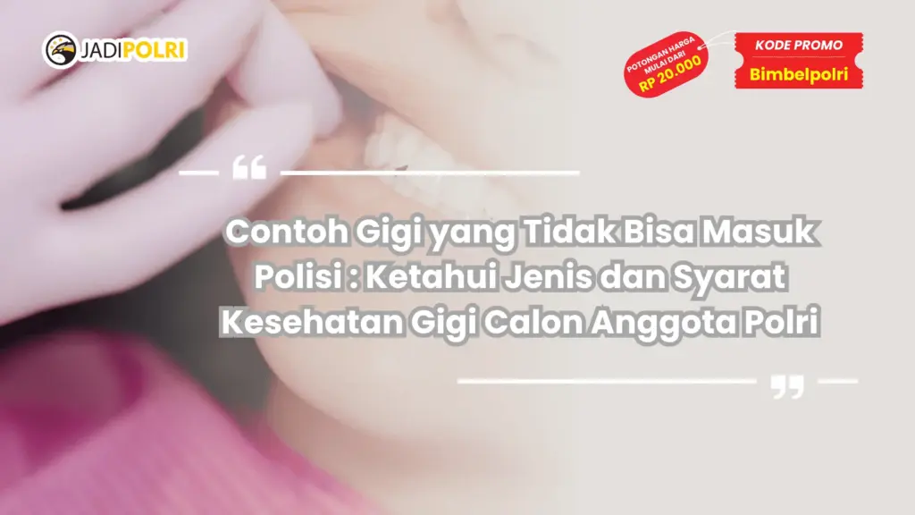 Contoh Gigi Yang Tidak Bisa Masuk Polisi
