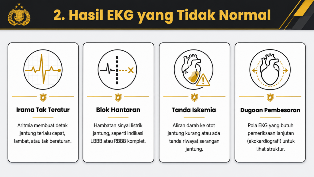 Hasil EKG yang tidak normal seperti apa